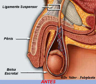 Aumentar o P&ecirc;nis